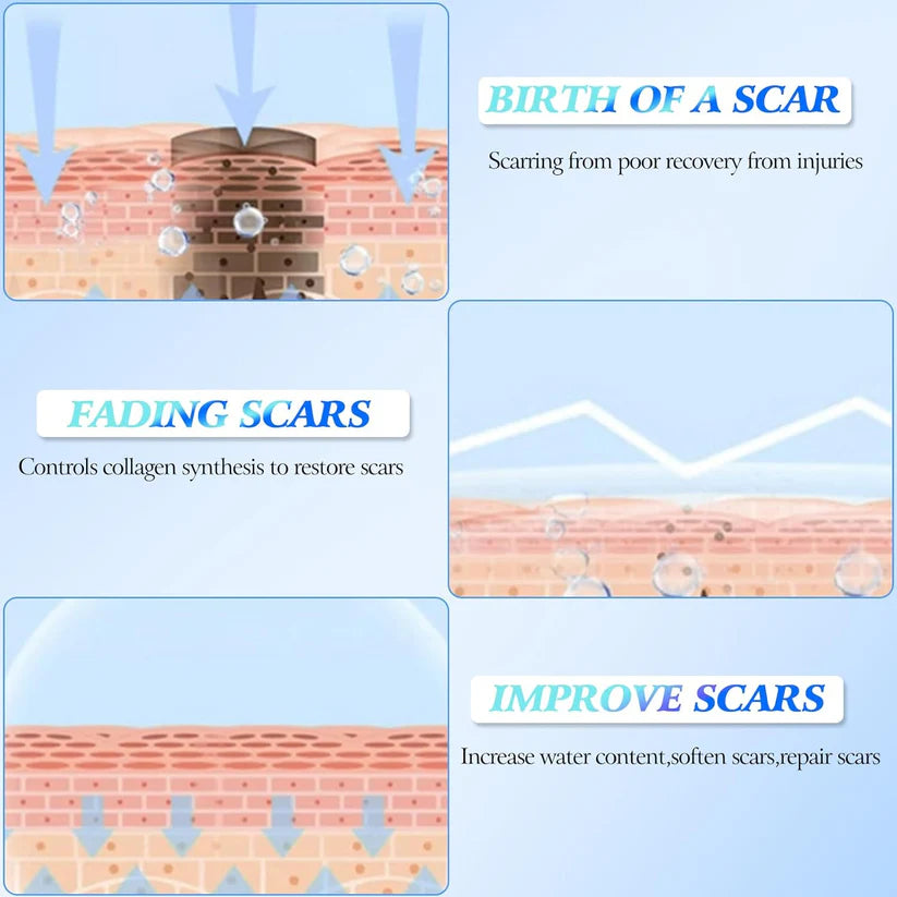 š„Limited Time Offerš„Skin Smoothing Scar Cream, Lighten & Repair All Scars