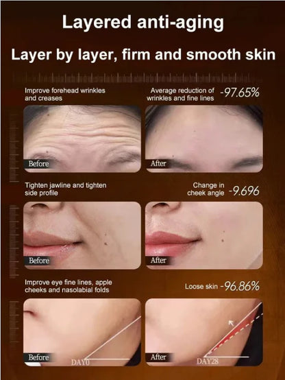 🏆Flash Sale⚡🔥Micro-molecular collagen anti-wrinkle lotion