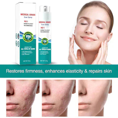 ⚡️LOVILDS™ Advanced Scar Spray For All Types of Scars - For example Acne Scars, Surgical Scars and Stretch Marks