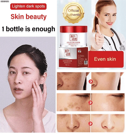BRIGHTENING FRECKLE CREAM-BUY 2 GET 1 FREE💥