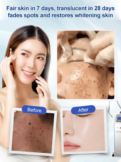 🎁2025 Hot Sale🎁Spot Fading Urea Cream