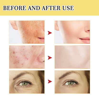 Snail 96 Serum Essence + Snail 92 Multi-Effect Cream