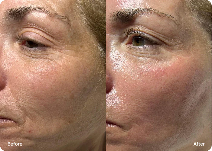 Korean Turn Back Time on Aging Skin Time Reverse Cream