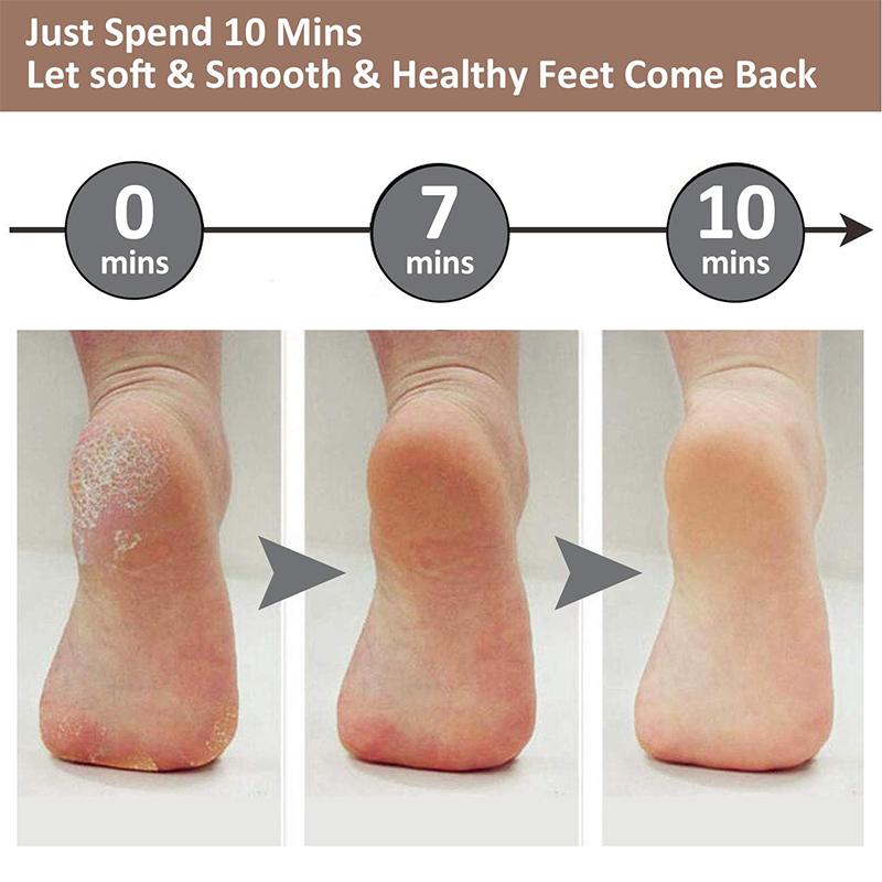 2021 New Pedicure Foot File
